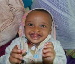 Beleste Before Surgery