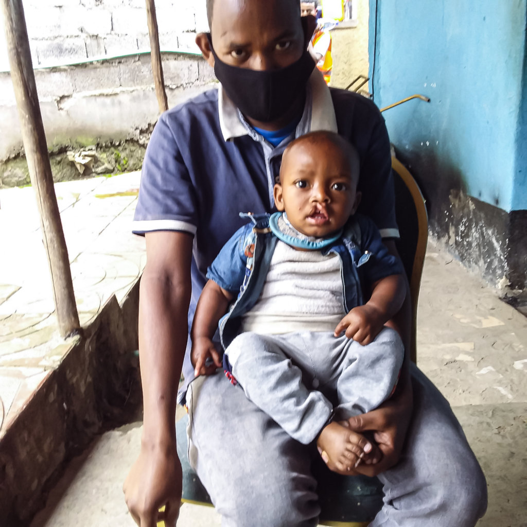 Provide safe access to 25 cleft surgeries
