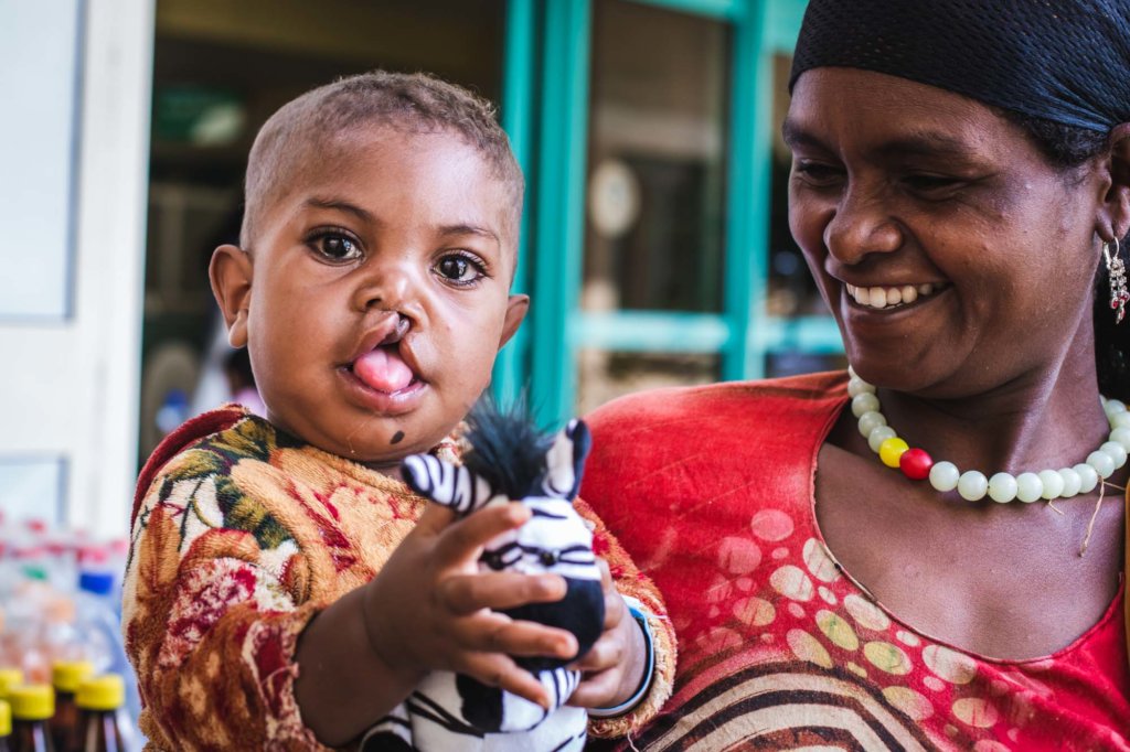 Provide safe access to 25 cleft surgeries