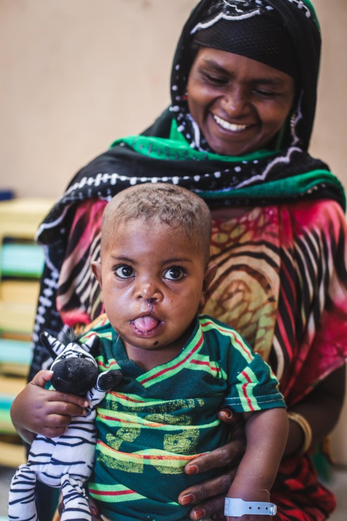 Provide safe access to 25 cleft surgeries