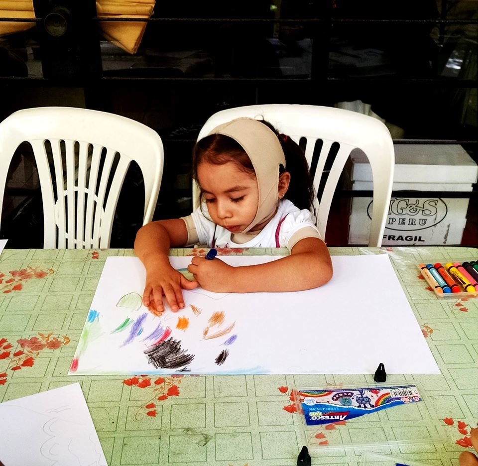 Let's give hope to 150 burned children in Peru