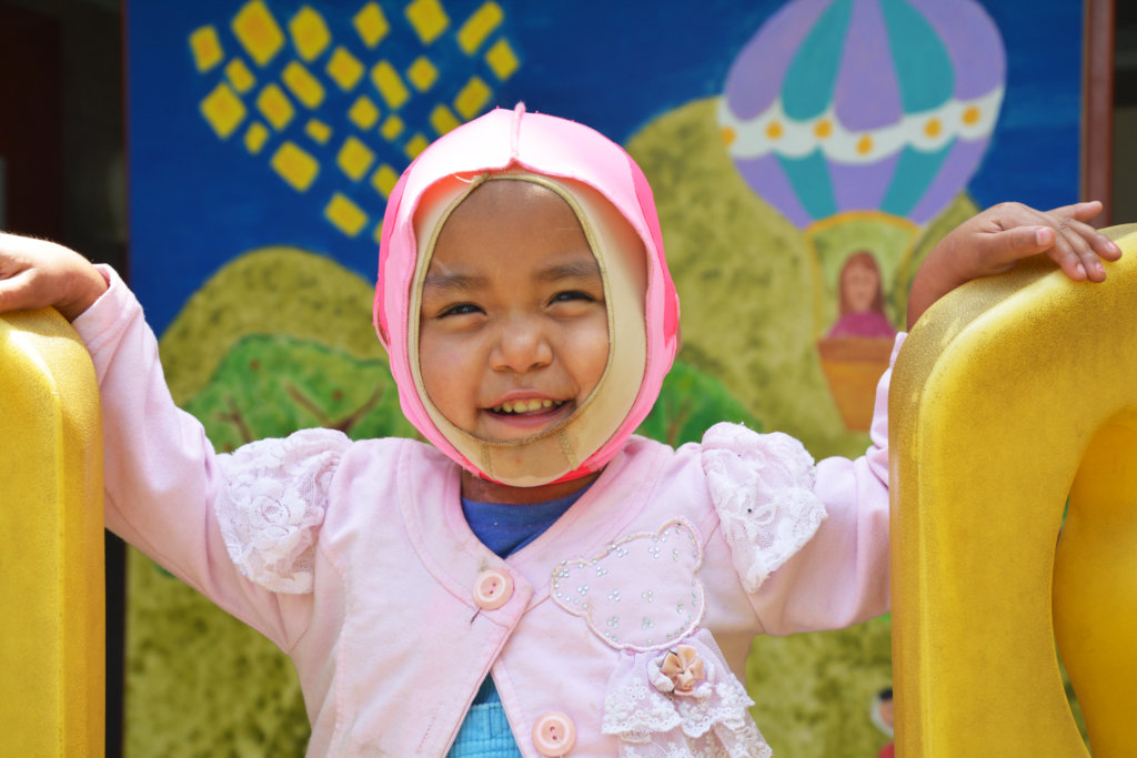 Let's give hope to 150 burned children in Peru