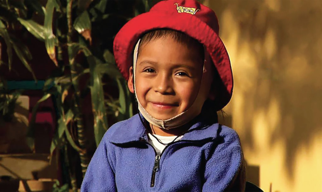 Let's give hope to 150 burned children in Peru