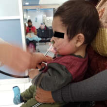 ALEX AFTER HIS FIRST SURGERY