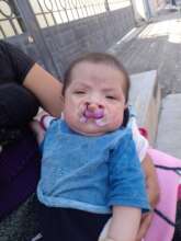 Bayby boy with his pediatric dental plaque