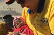 Polio - Help eradicate this terrible disease