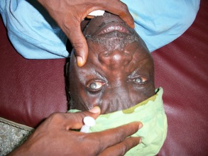 Cataract patient