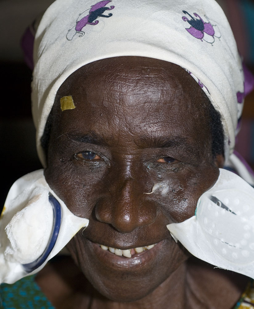 Outreach Eye Camps in Ghana