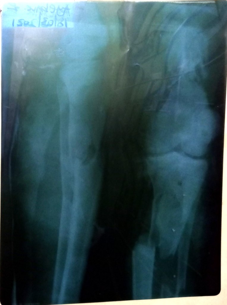 Help one family pay for medical expenses