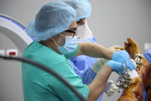 External Fixation to the patient