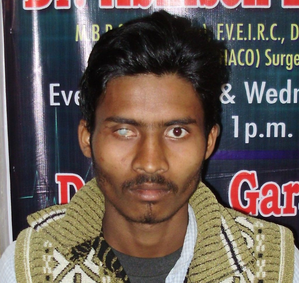 RANCHI EYE CARE CENTRE