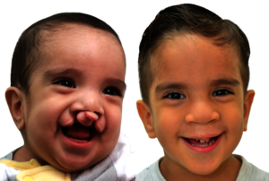 A healthy smile for David Josue!