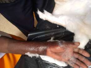 Patients injured hand