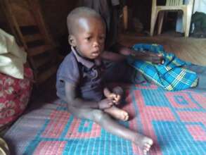 Sick child,  poor child birth,