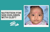 Protect 500 Cleft Kids from Covid-19