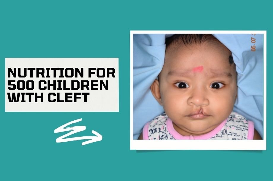 Protect 500 Cleft Kids from Covid-19