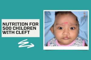 Protect 500 Cleft Kids from Covid-19