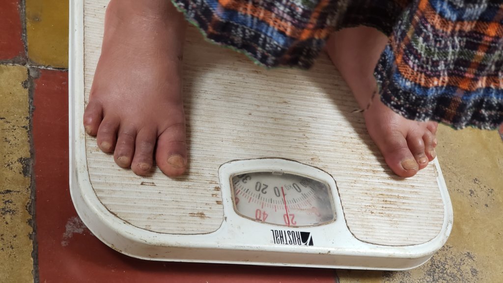Feed & Heal 100 malnourished children in Guatemala