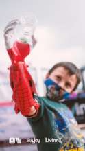 Prosthesis -Solutions for life and happiness