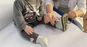 ABC Health Foundation Clubfoot Program
