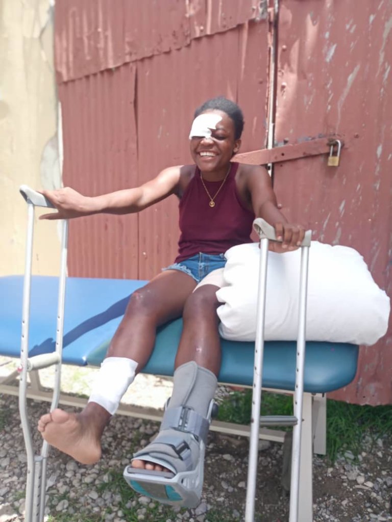 Haiti earthquake response: Rehab & Prosthetics