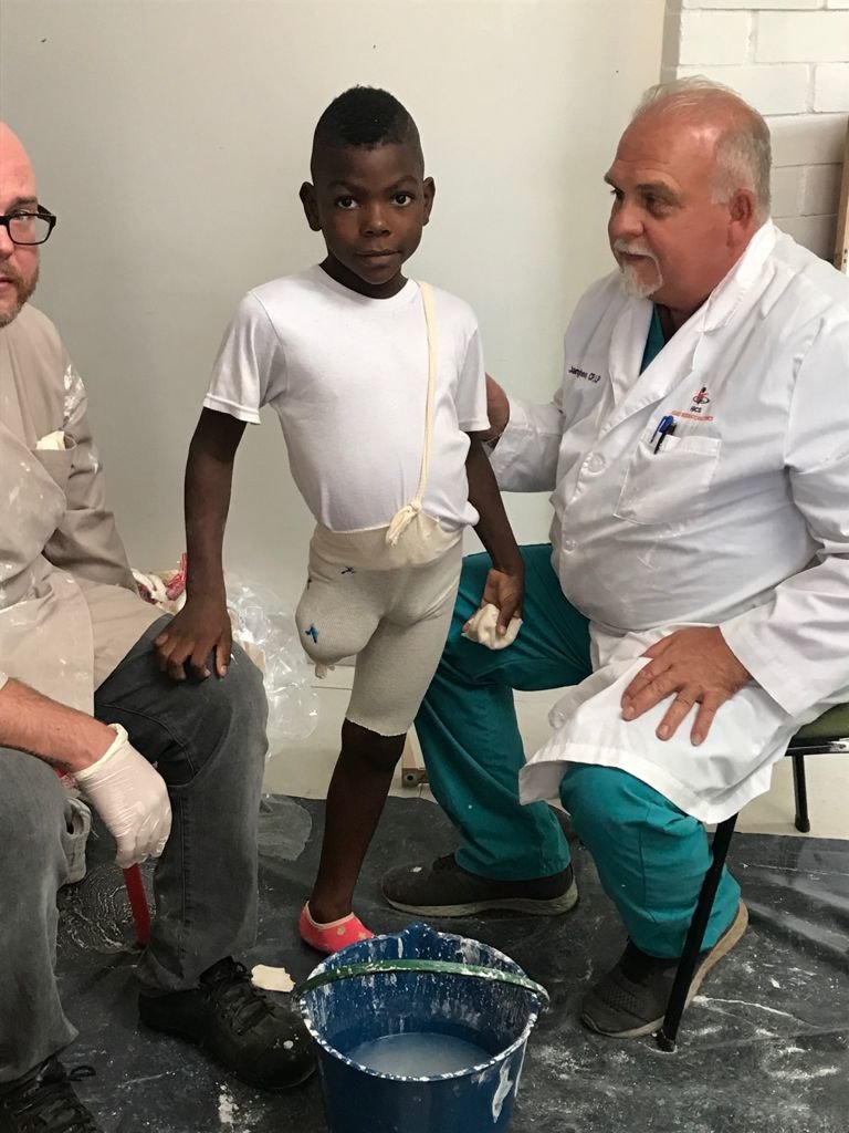 Donate prostheses for Colombian amputees