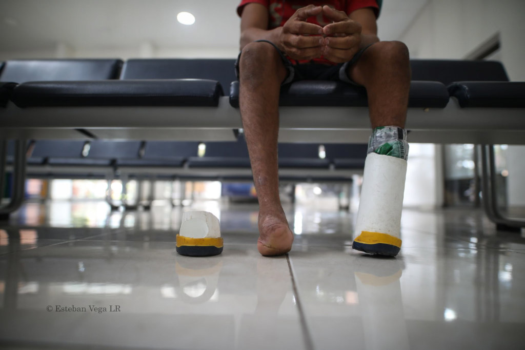 Donate prostheses for Colombian amputees