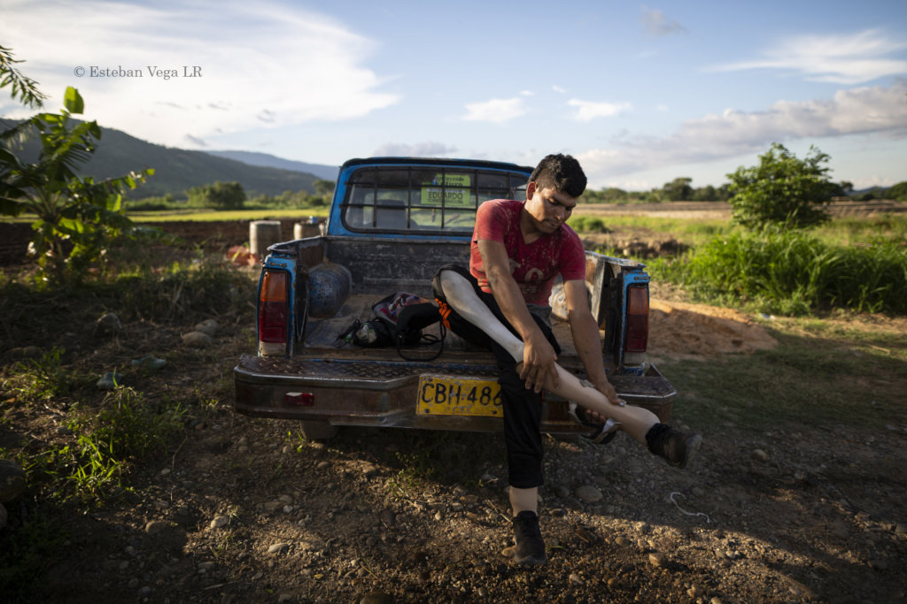 Donate prostheses for Colombian amputees