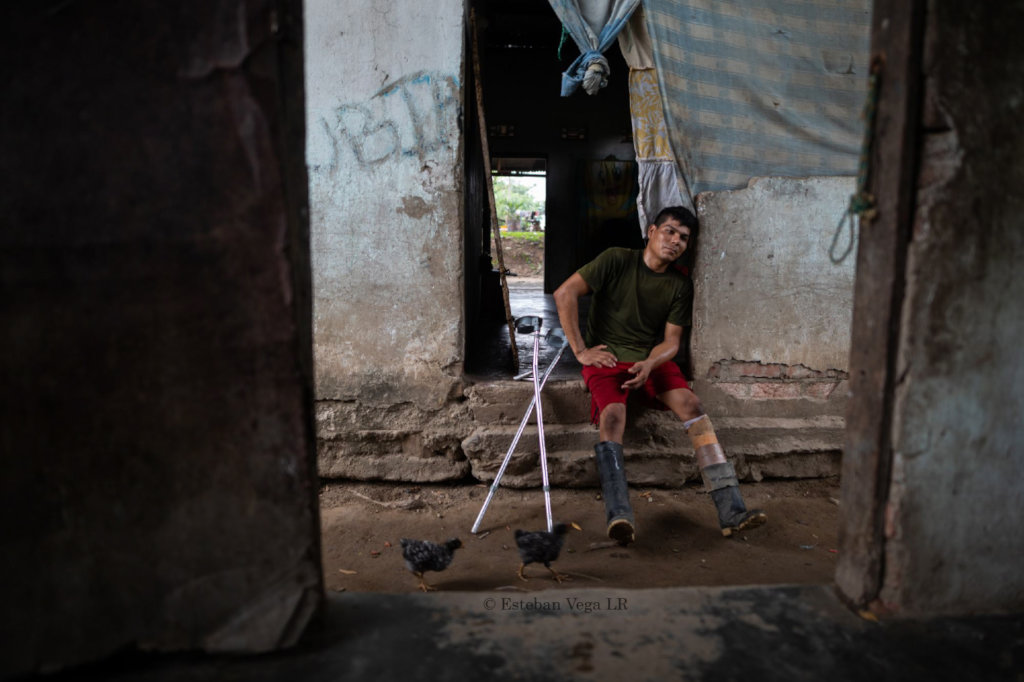 Donate prostheses for Colombian amputees