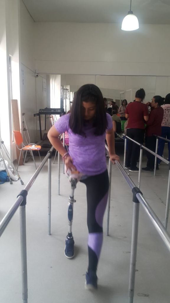 Donate prostheses for Colombian amputees