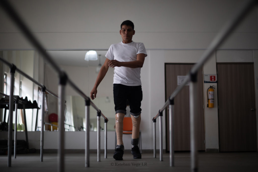 Donate prostheses for Colombian amputees