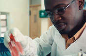 AIDS Vaccine Research in Uganda