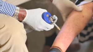 Cryotherapy is a vital skin cancer prevention tool