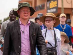 People with albinism taking part in IAAD event