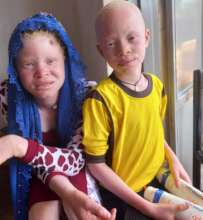 Siblings with albinism in Bugweri District