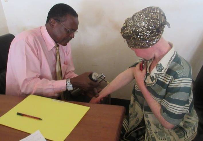 End skin cancer for people with albinism in Uganda