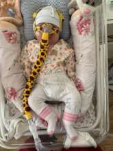 A nasal mask for 2 m.o. baby with SMA disease