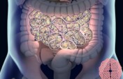 Impact Probiotics on Microbiota Autistic Spectrum