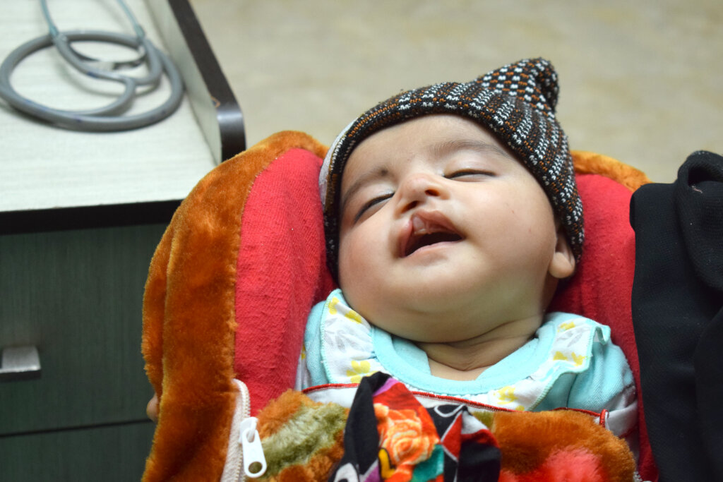 Restore Smiles of Cleft Patients