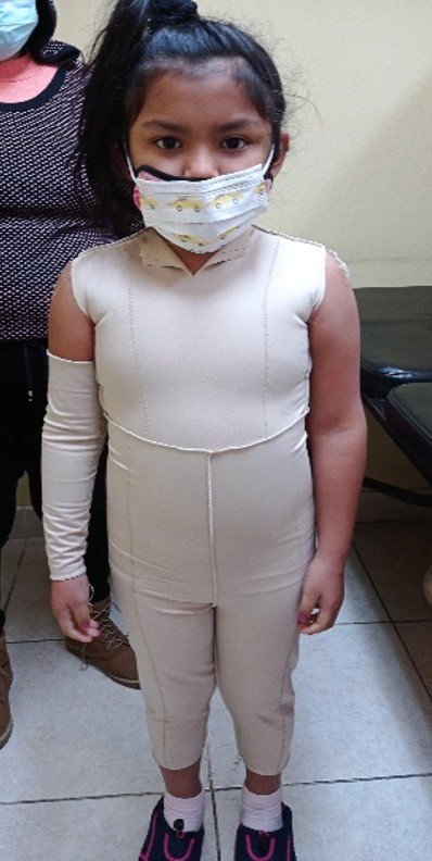 Changing scars into hope