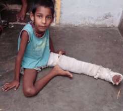 Karan with his broken leg at home