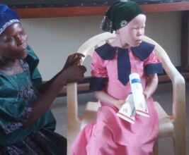 For people with albinism sunscreen is a life-saver