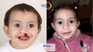 Aline's healthy smile!