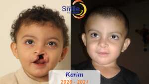 Karim's healthy smile