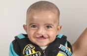 Help 10 Children Born with Cleft in Lebanon/MENA