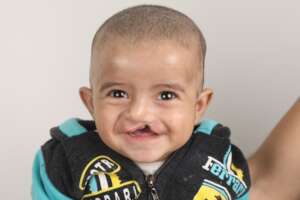 Help 10 Children Born with Cleft in Lebanon/MENA
