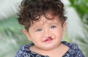 Saving Lives for Children born with Cleft