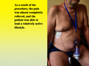 Pain Pump