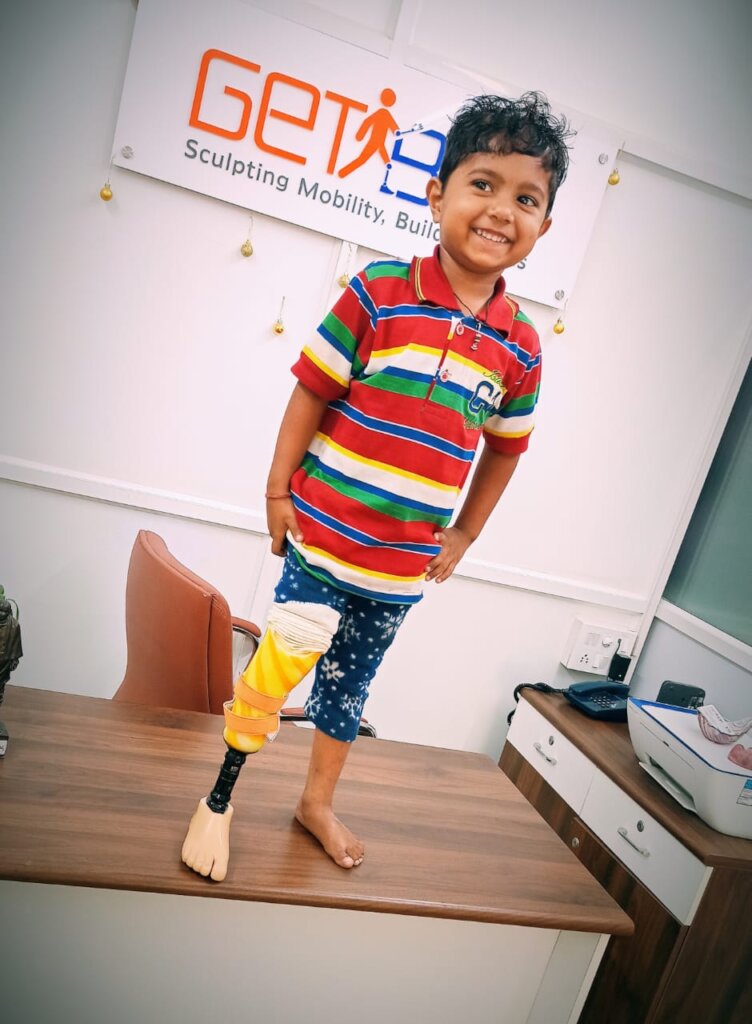 Empower 10 kids in India with Prosthetic Limbs