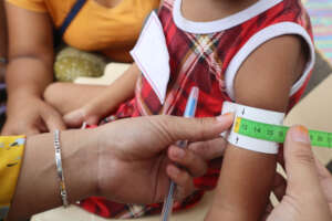 Assessing and identifying malnourished children